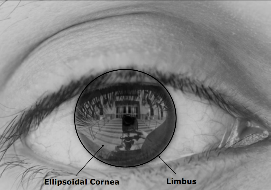 Limbus Tespiti